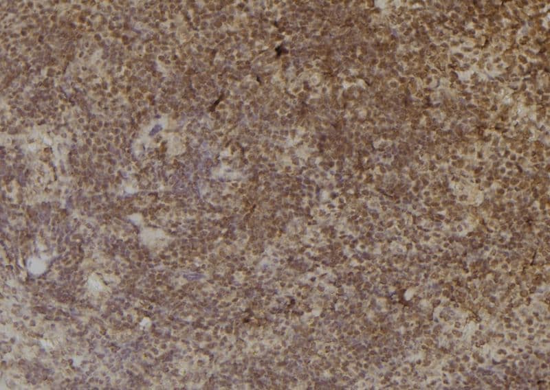 Polyclonal Rabbit anti-Human CBR3 Antibody (IHC, IF, WB)