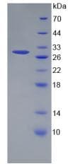 Human CCDC3 Protein (Recombinant His-T7)