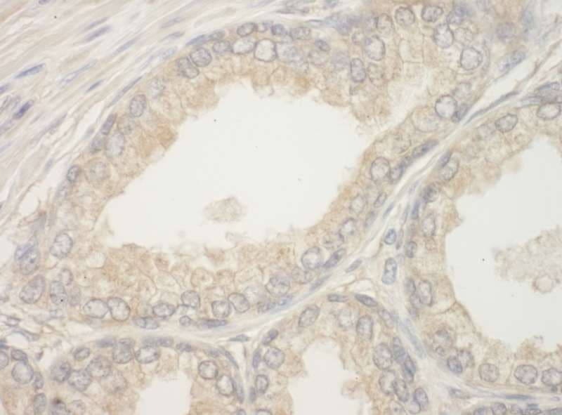 BAD Antibody (aa1-50)