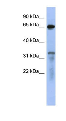 RAP1GAP Antibody (aa503-552)