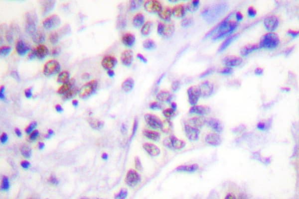 Polyclonal Rabbit anti-Human SAE2 / UBA2 Antibody (Ser621, IHC, IF, WB)
