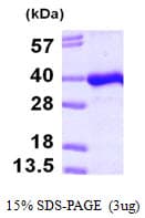 Human PITPNB Protein (Recombinant His)