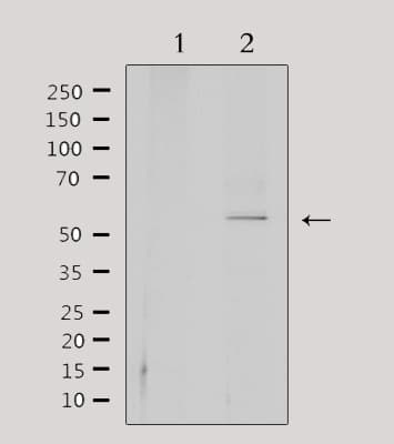 Polyclonal Rabbit anti-Human CEP55 Antibody (IHC, WB)