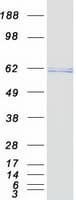 Human TERF2 / TRF2 Protein (Recombinant Myc-DDK (Flag))