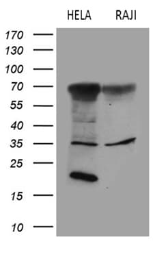 Monoclonal Mouse anti-Human FCRLB / FREB-2 Antibody (clone OTI4C4, aa202-426, WB)