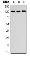 Polyclonal Rabbit anti-Human PRDM10 / TRIS Antibody (Internal, WB)