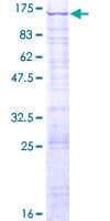Human LAS1L Protein (Recombinant GST)