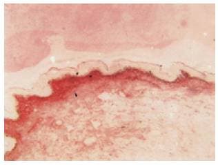 Procollagen Type I Antibody (N-Terminus, clone M-58)