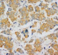 FGF4 Antibody (C-Terminus, Sepharose)