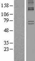 ALAS1 Protein (Over-Expression Lysate Myc-DDK (Flag))