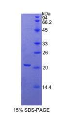 Human APOD / Apolipoprotein D (Recombinant His)