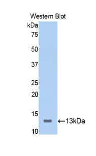 ICOS / CD278 Antibody (aa39-133)
