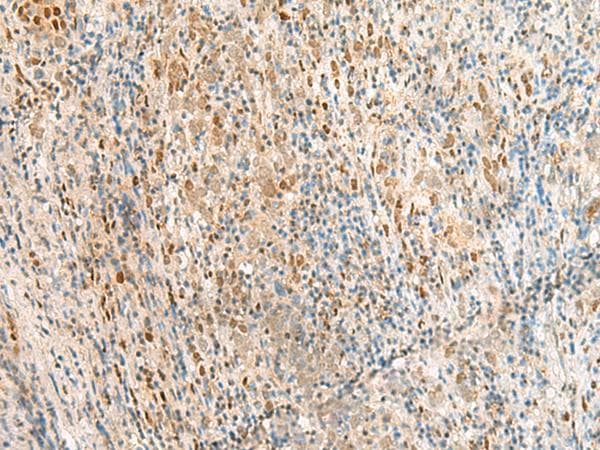 Polyclonal Rabbit anti-Human RPS27A Antibody (IHC)