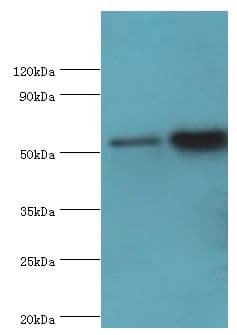 Polyclonal Rabbit anti-Human DPP2 / DPP7 Antibody (aa190-410, IHC, WB)