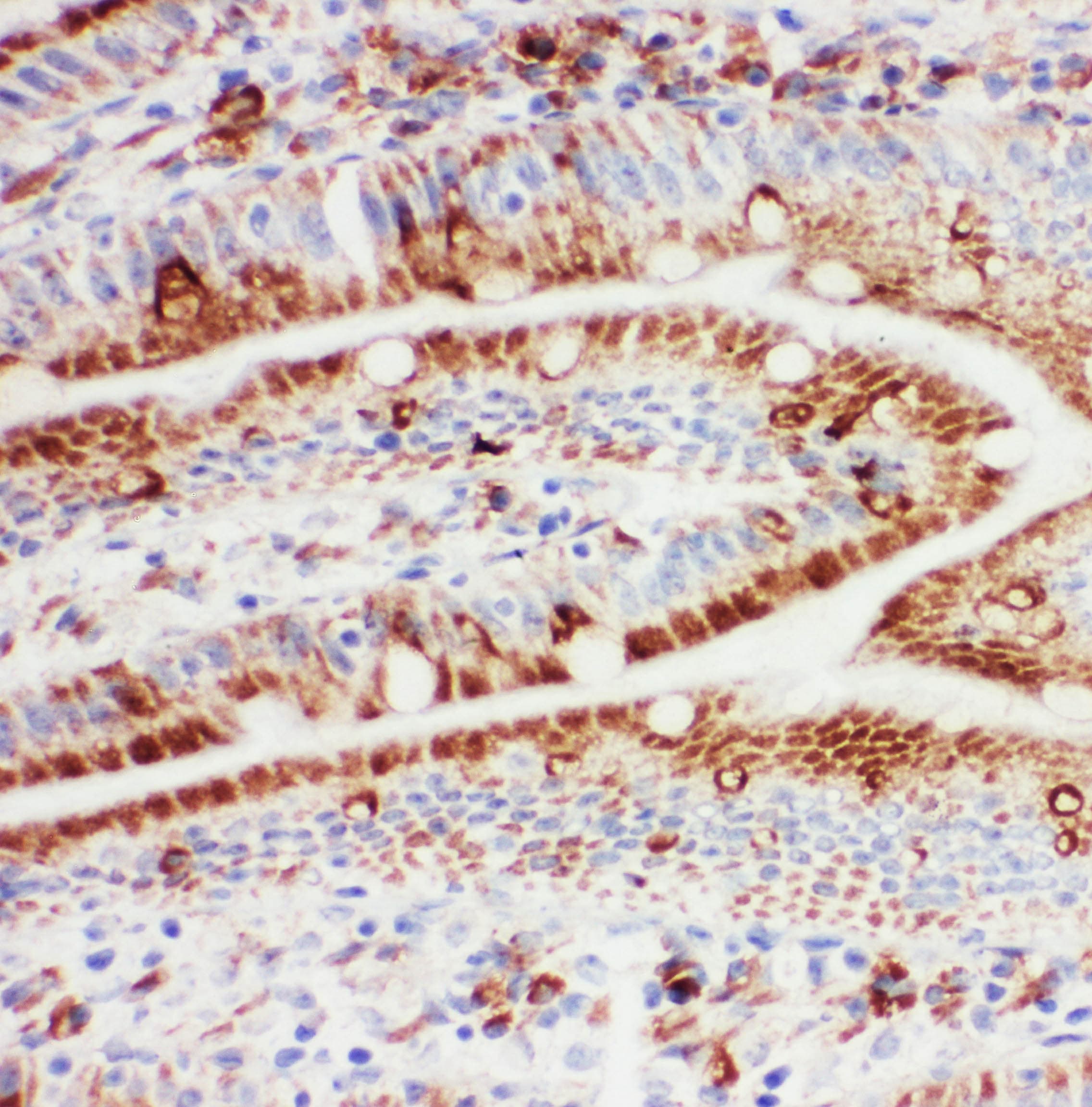 HSPH1 / HSP105 Antibody (aa713-733)