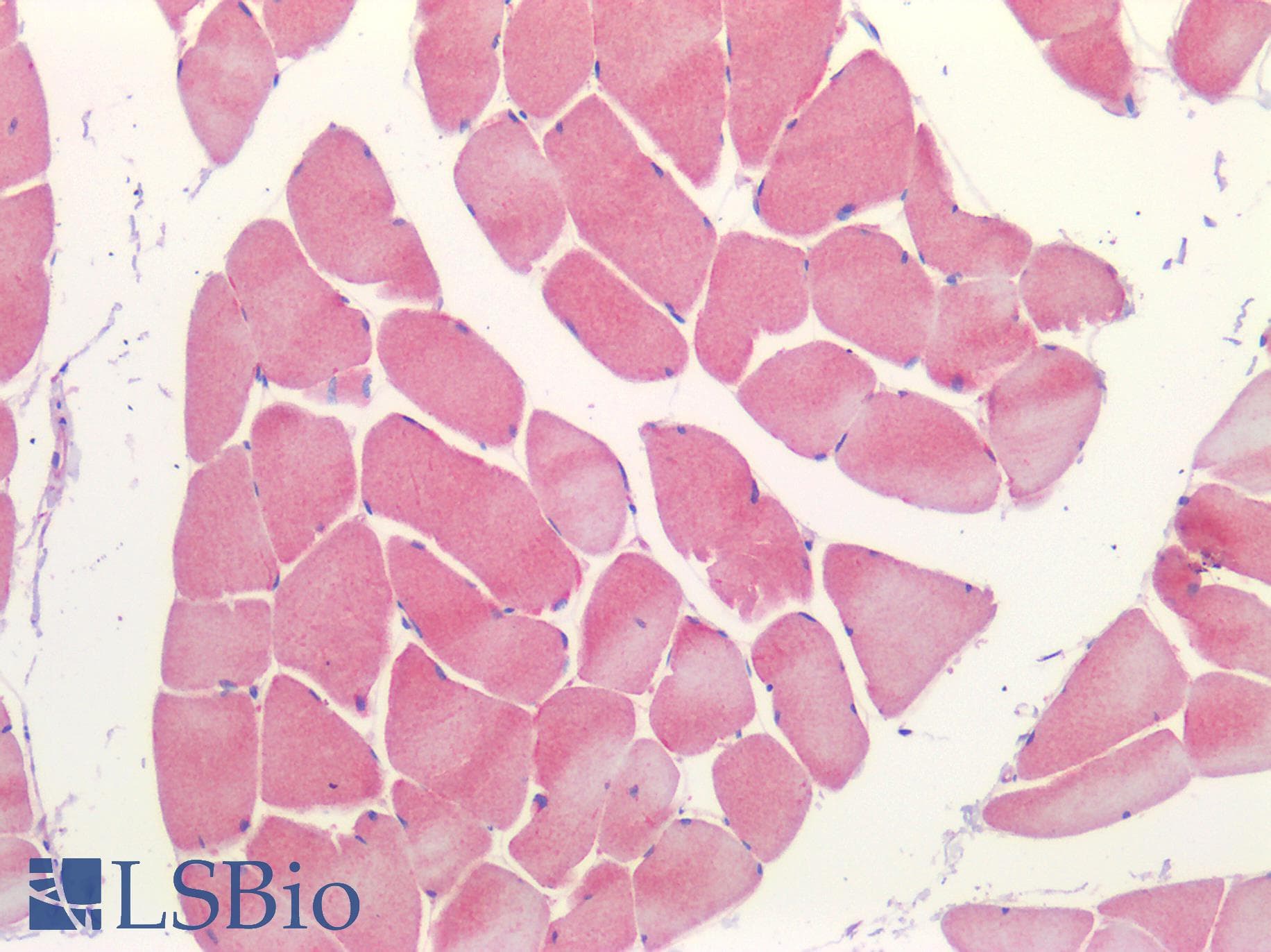 IHC-plus™ P2RX3 / P2X3 Antibody