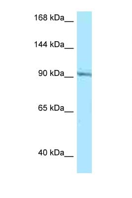 RASGRP1 / RASGRP Antibody (aa617-666)