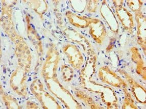 Polyclonal Rabbit anti-Human GSTA2 Antibody (aa1-222, IHC, WB)