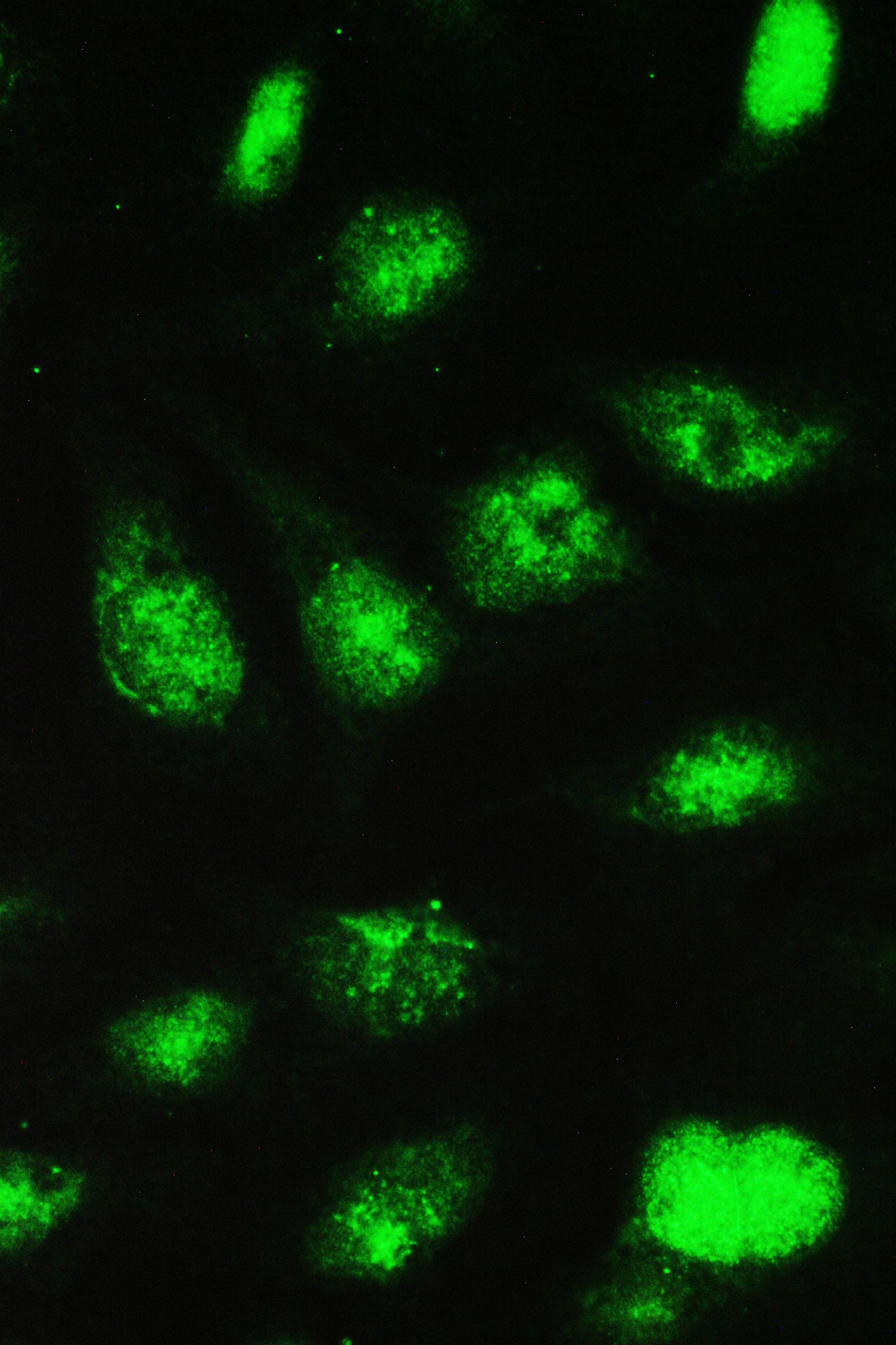 UBE2I / UBC9 Antibody