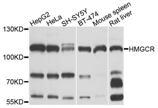 Polyclonal Rabbit anti-Human HMG-CoA Reductase / HMGCR Antibody (IHC, IF, WB)