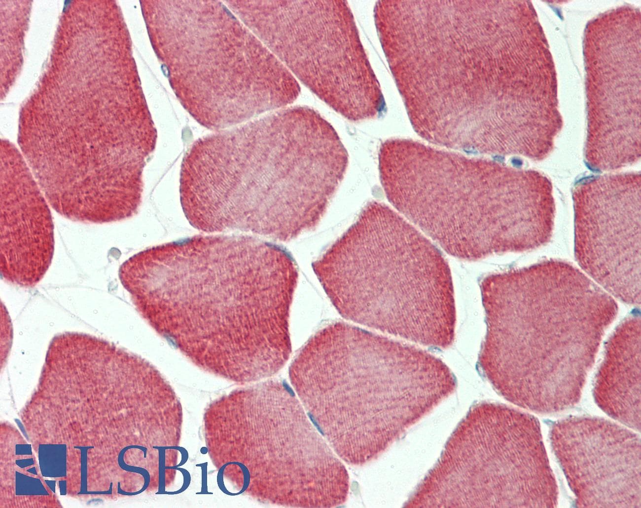 IHC-plus™ KBTBD13 Antibody (aa409-438)
