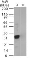SARS-CoV NSP3b Antibody (aa31-45)