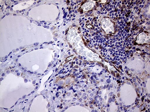 Monoclonal Mouse anti-Human MLPH / Melanophilin Antibody (clone OTI6E3, Carrier-free, aa295-600, IHC, WB)