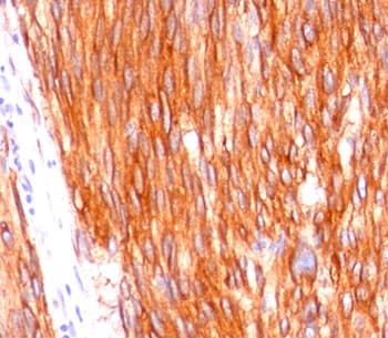 c-Kit / CD117 Antibody (clone C117/370, Azide-free, BSA-free)