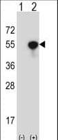NCK1 / NCK Antibody (aa63-92)