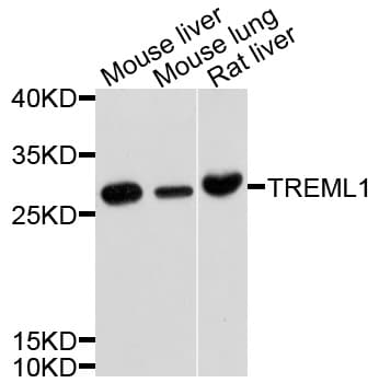 TREML1 / TLT1 Antibody
