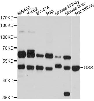 GSS / Glutathione Synthetase Antibody
