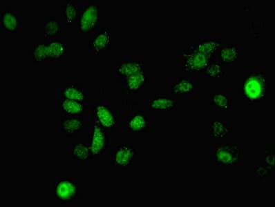 MAP2K3 / MEK3 / MKK3 Antibody