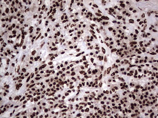 HNRNPL / hnRNP L Antibody (aa270-502, clone OTI9F11, Carrier-free)