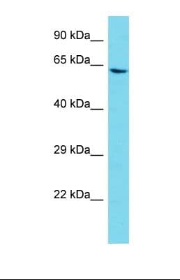 Polyclonal Rabbit anti-Human AGAP11 Antibody (aa395-443, WB)