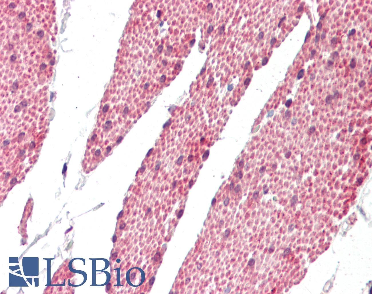 RASSF6 Antibody (aa135-184)