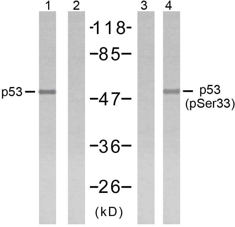 Polyclonal Rabbit anti-Human TP53 / p53 Antibody (phospho-Ser33, WB)