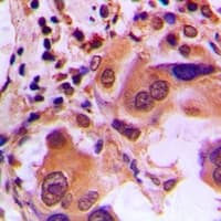 BRCA1 Antibody (C-Terminus)