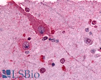 IHC-plus™ GRM2 / MGLUR2 Antibody (N-Terminus)