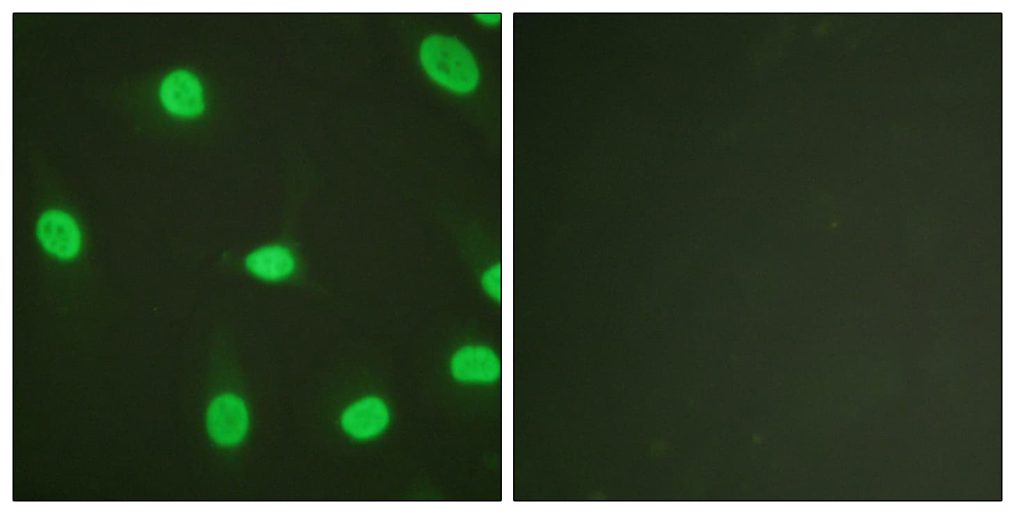 Polyclonal Rabbit anti-Human XRCC5 / Ku80 Antibody (aa683-732, IHC, IF, WB)