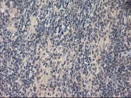 Monoclonal Mouse anti-Human EIF4E2 / IF4e Antibody (clone OTI1C1, IHC, WB)