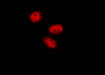 STAT3 Antibody (phospho-Tyr705)