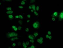 TP53 / p53 Antibody (clone OTI2C4)
