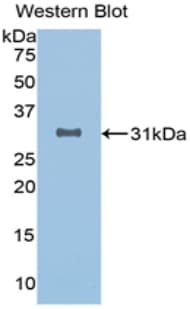 SIRT3 / Sirtuin 3 Antibody (aa126-382, APC)