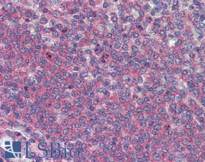 IHC-plus™ ADAM8 Antibody