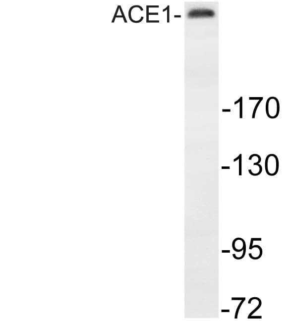 MAP2 Antibody (aa14-63)