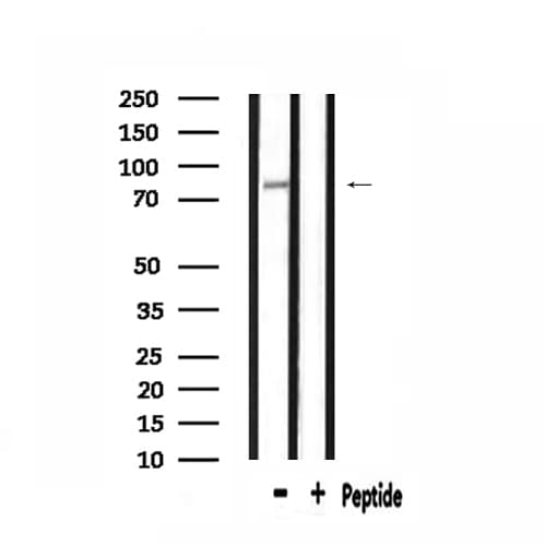 Polyclonal Rabbit anti-Human CDH3 / P-Cadherin Antibody (IHC, IF, WB)