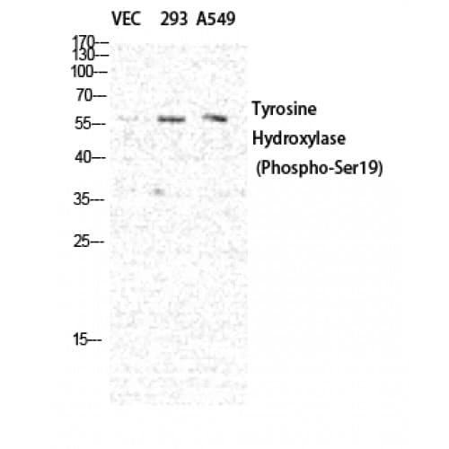 TH / Tyrosine Hydroxylase Antibody (10-90 aa)