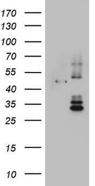 DDOST / OST48 Antibody (aa131-378, clone OTI2H2)