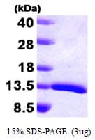 Human HDGF Protein (Recombinant)