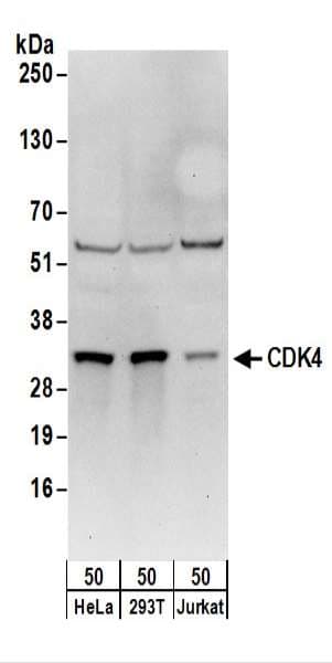 Polyclonal Rabbit anti-Human CDK4 Antibody (aa253-303, IHC, WB)